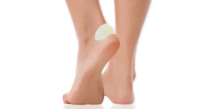 Puchýř na noze zakrytý náplastí na puchýře