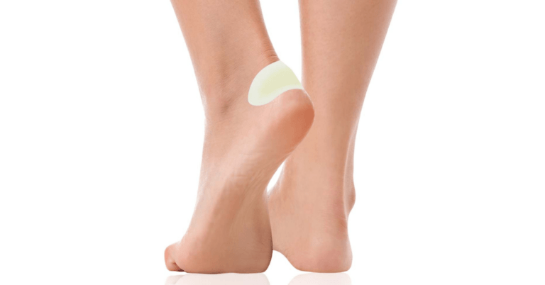 Puchýř na noze zakrytý náplastí na puchýře